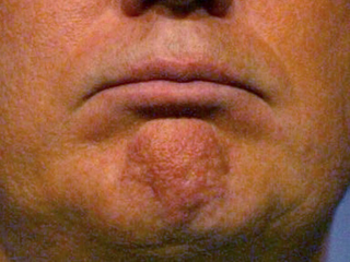 Illustration for article titled A Visual History of Donald Trump's Mouth